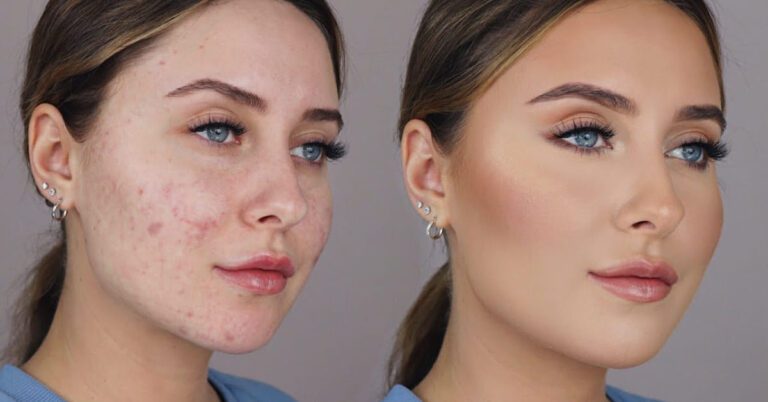 Makeup that Covers Scars Concealing and Enhancing A Comprehensive Guide